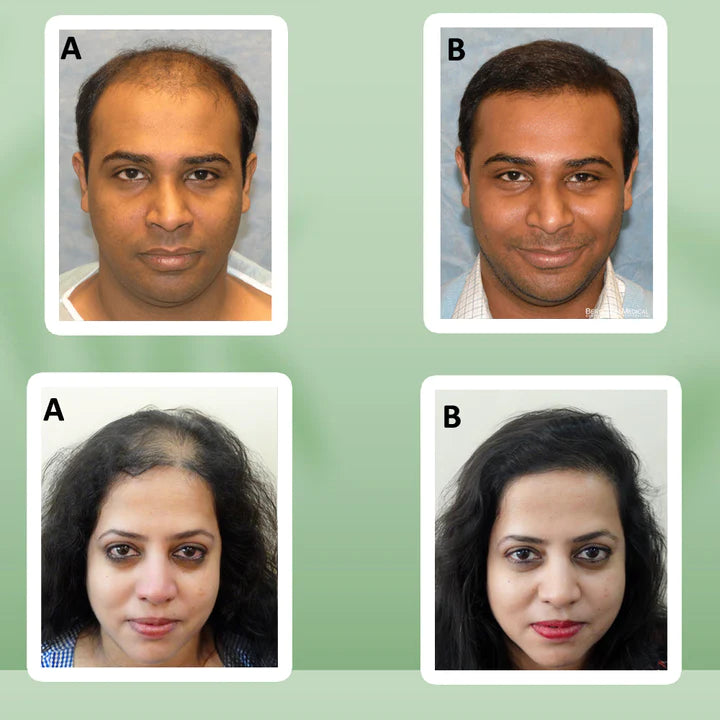 Mysore Adivasi Neelambari Hair Growth Oil - 250 ML (45 DAYS TRAIL PACKAGE)